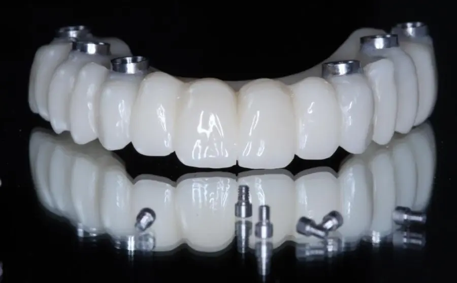 Arcada de circonio sobre implantes con los tornillos de fijación