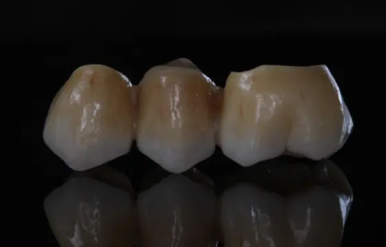 Tres coronas de cerámica con su reflejo