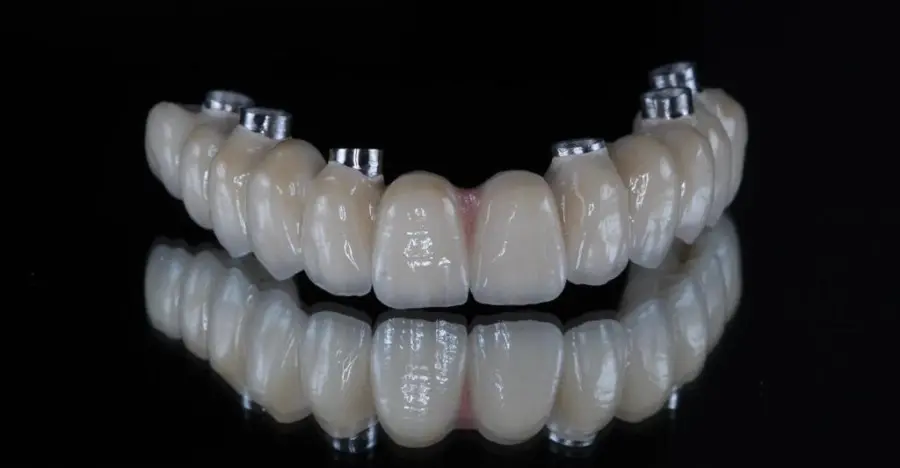 Prótesis superior e inferior sobre implantes con sus pilares